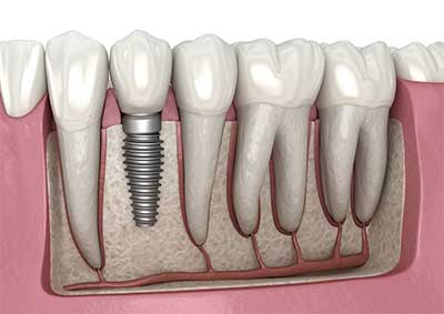 Ailesbury Oral Surgery Treatments