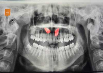 Ailesbury Oral Surgery Treatments