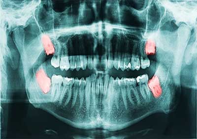 Ailesbury Oral Surgery Treatments